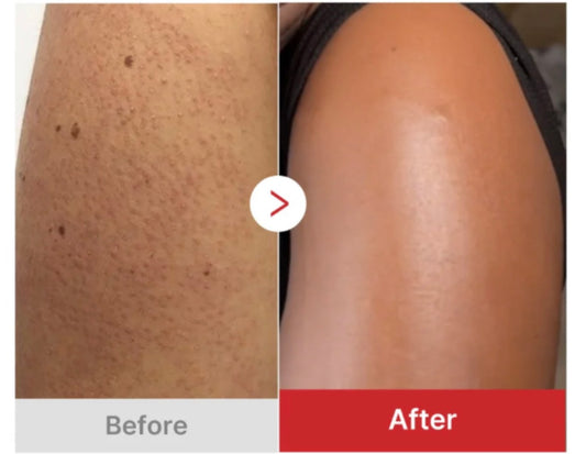 Medicube Hypochlorous Acid Body Peel Shot